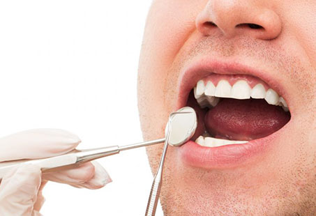 How to remove tartar from teeth