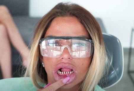 Katie price teeth