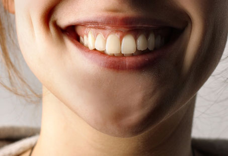 White Spots on Teeth: Causes & 10 Ways To Get Rid of Them