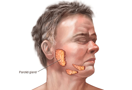 Sjögren’s Syndrome: Oral Signs, Symptoms & 7 Ways To Manage Them