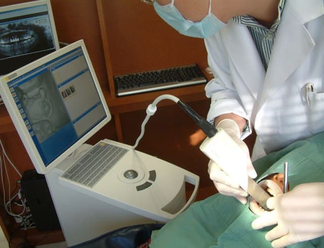 CEREC computer software