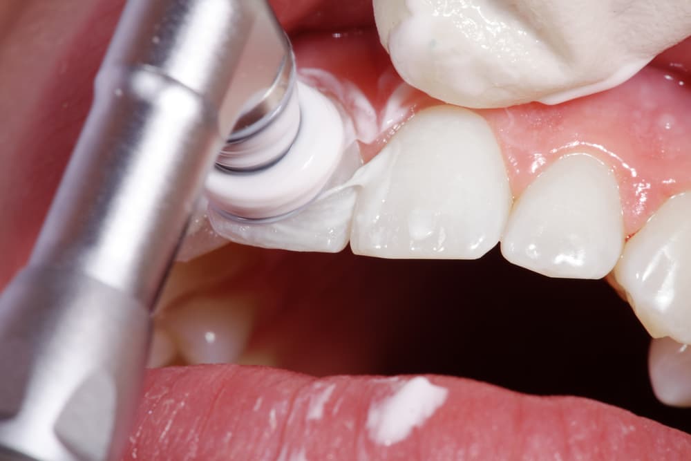 Teeth
