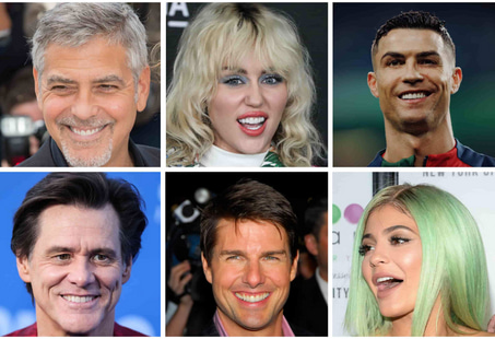celebrities with veneers