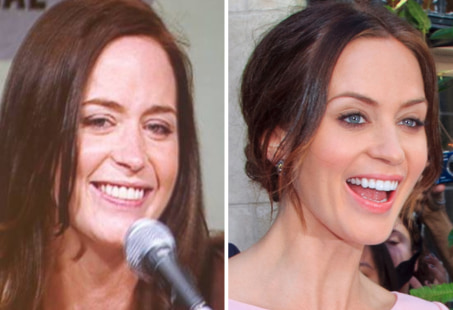 Emily Blunt teeth
