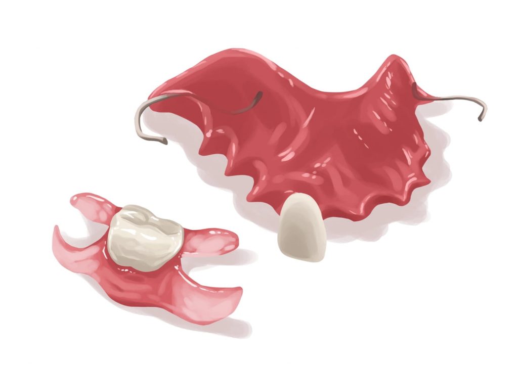different flipper tooth
