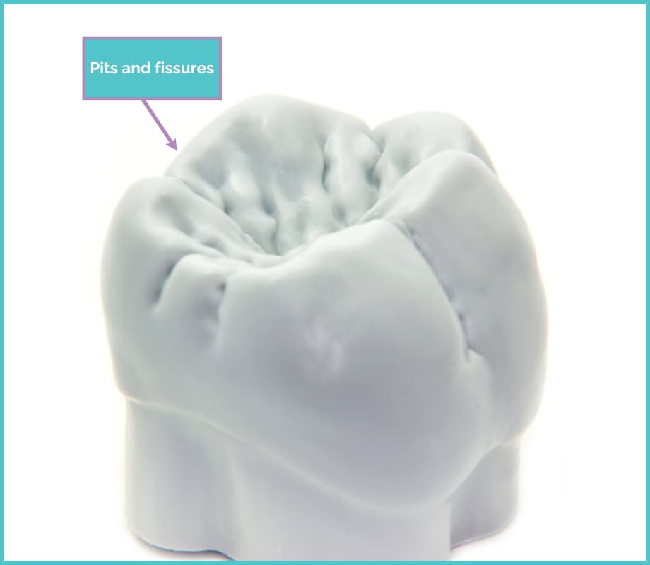 tooth surface