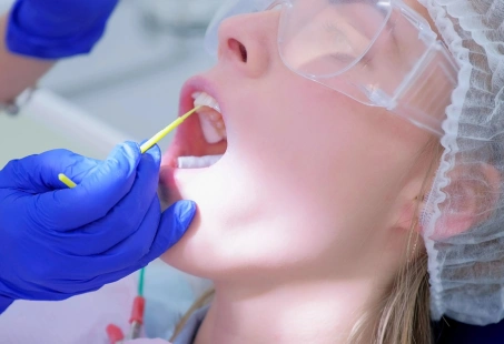 Is Fluoride Varnish Worth It?