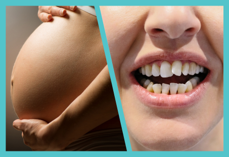 Dentist Warns Mums-To-Be Of The Impact Of Pregnancy On Oral Health