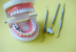 tooth decay