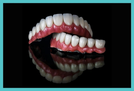 Dental implant-supported bridge replacing multiple missing teeth in the upper jaw, secured with two dental implants