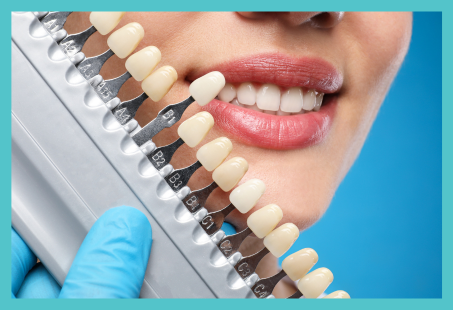 A dentist holding a tooth shade guide next to a smiling patient to match the correct colour for cosmetic dental treatment.